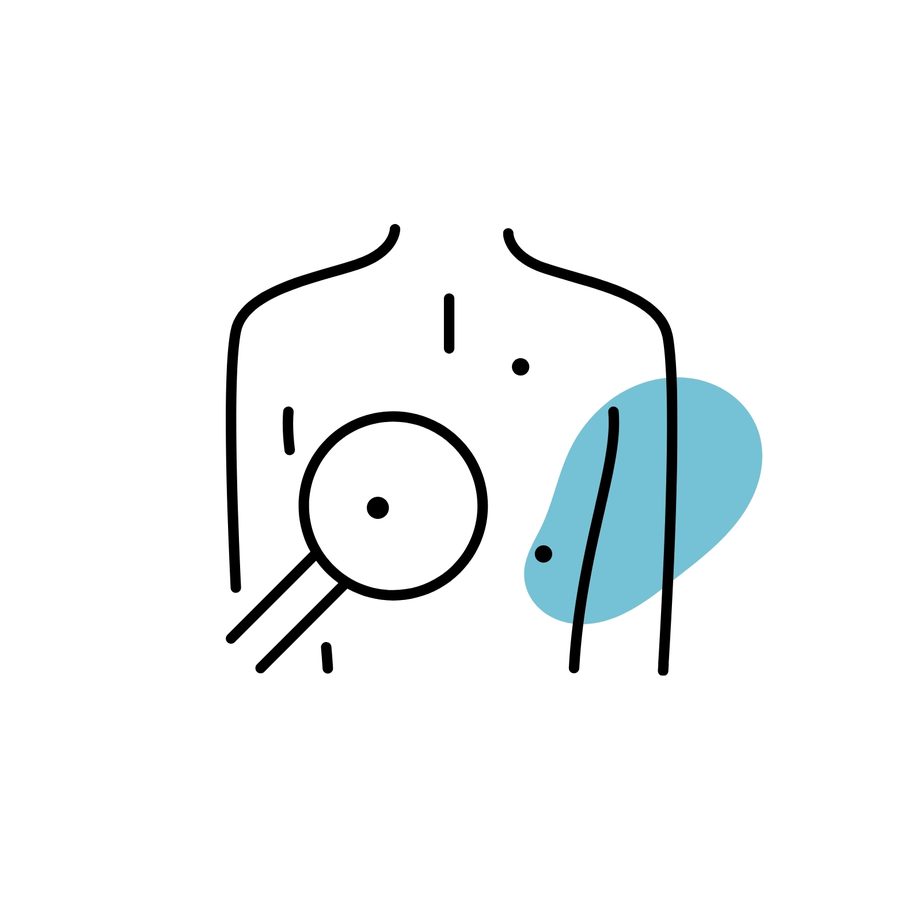 Warts Removal